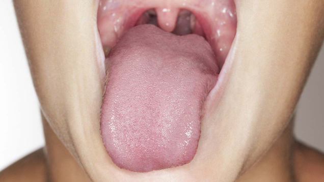 Illustration for article titled Live A Little! Press Your Tongue Against These 10 Pictures Of Tongues
